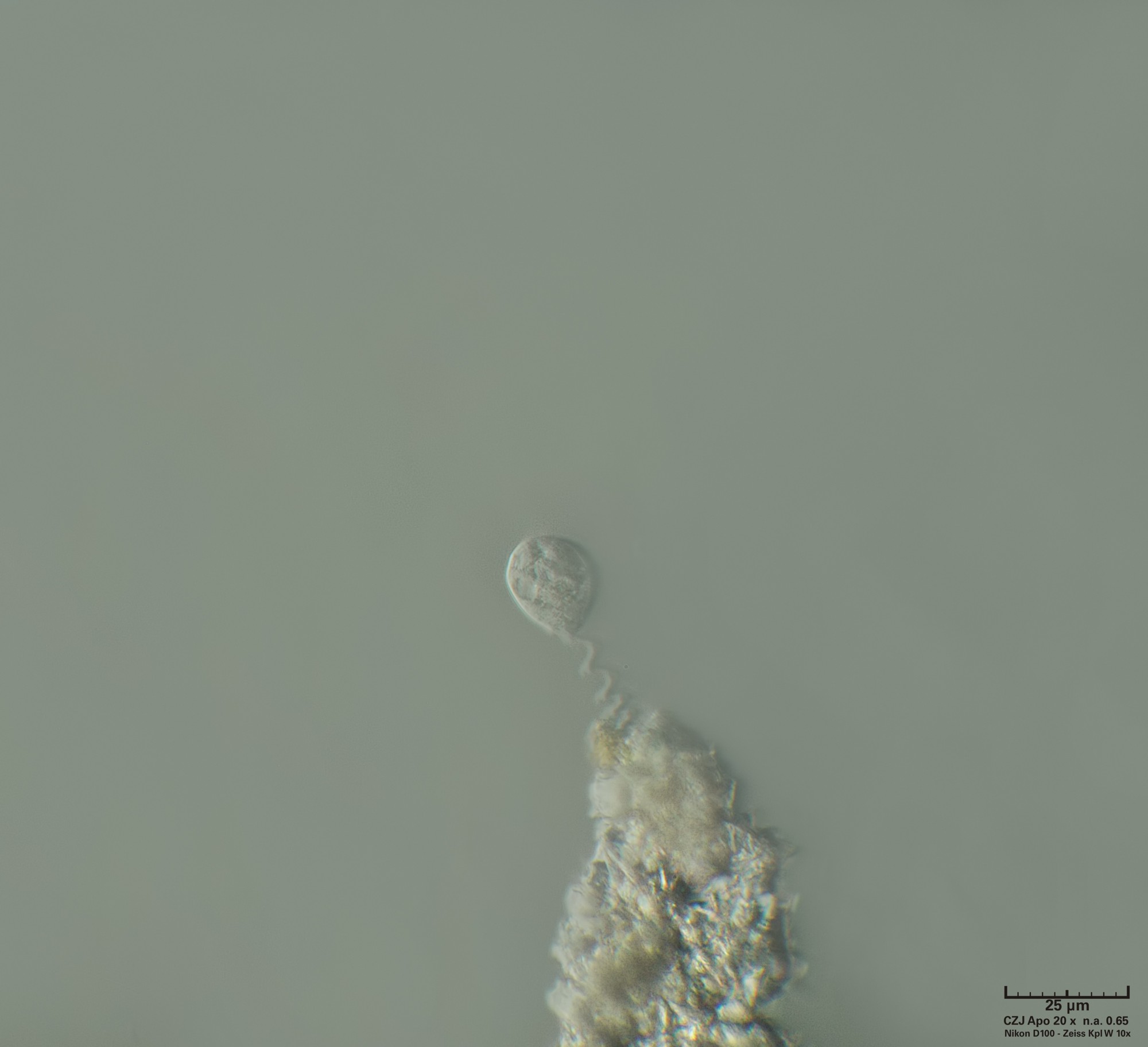 Vorticella